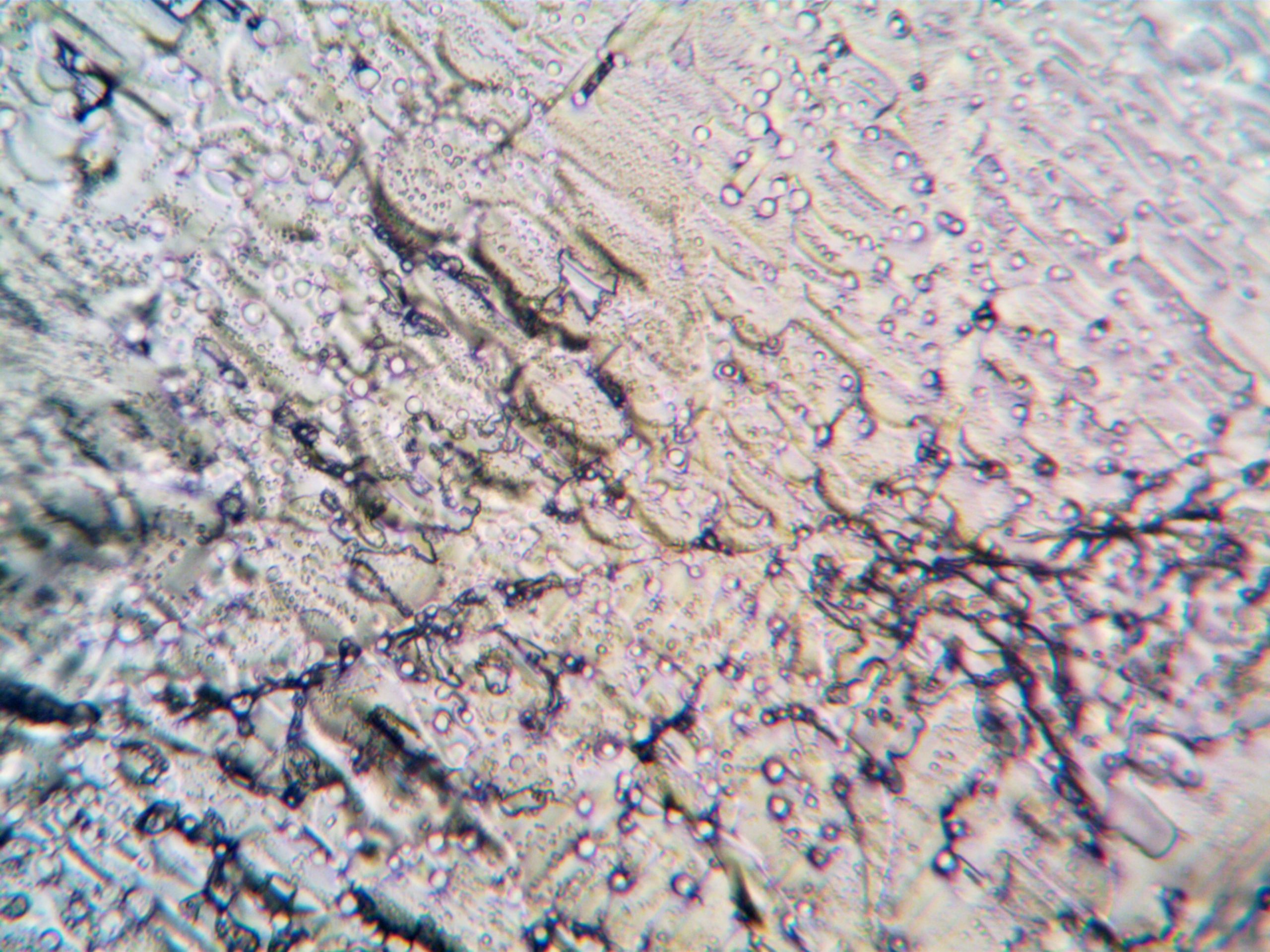 Cristaux amiante sous microscope haute résolution